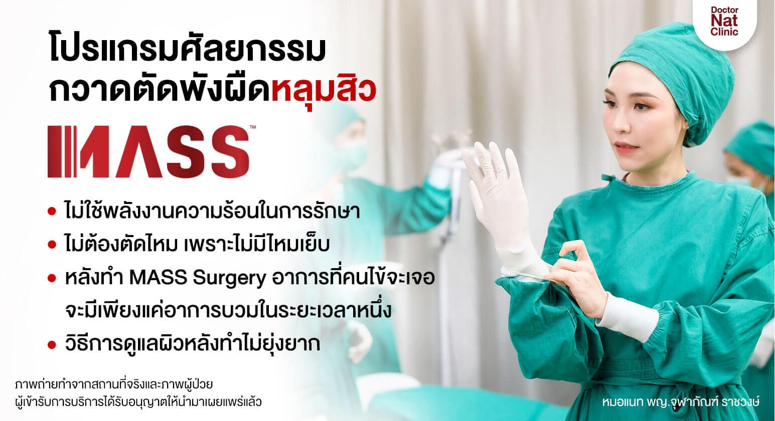 MASS รักษาหลุมสิวไม่ใช้ความร้อน