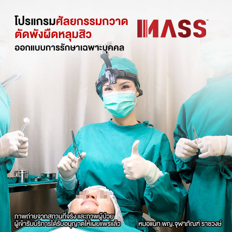 โปรแกรมศัลยกรรมกวาดตัดพังผืดหลุมสิว MASS