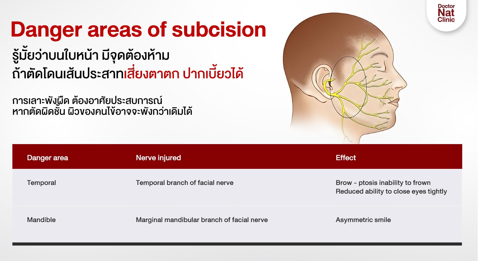 จุดต้องห้าม Subcision