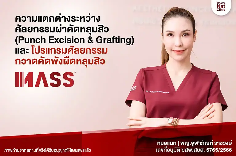 ศัลยกรรมผ่าตัดหลุมสิว VS ศัลยกรรมกวาดตัดพังผืดหลุมสิว