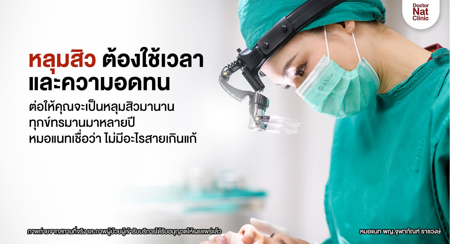 หลุมสิวต้องใช้เวลา