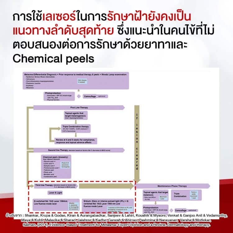 เลเซอร์ฝ้าทางเลือกสุดท้าย