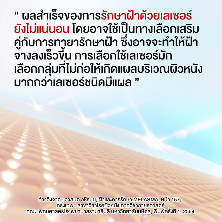 เลเซอร์ฝ้ายังไม่แน่นอน