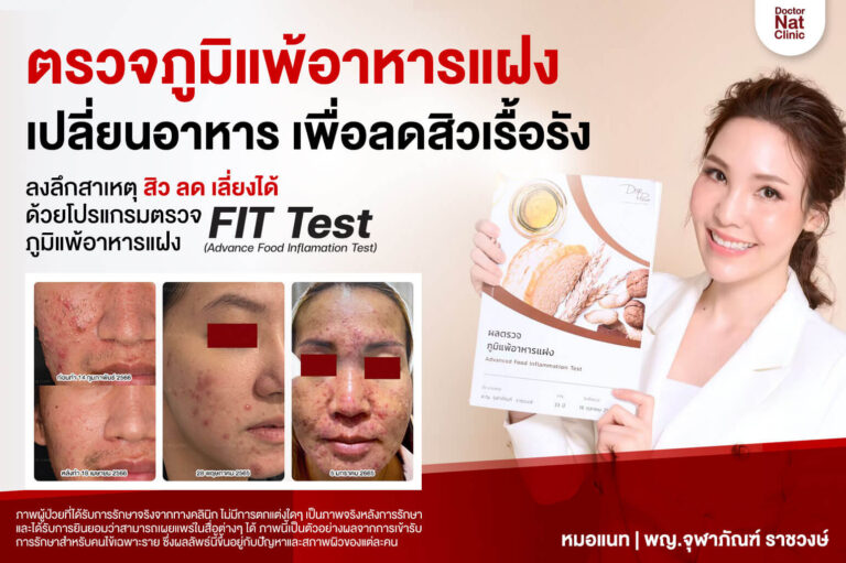 โปรแกรมตรวจภูมิแพ้อาหารแฝง FIT Test
