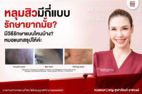 หลุมสิวมีกี่แบบ หมอแนท