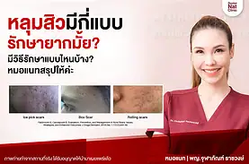 หลุมสิวมีกี่แบบ หมอแนท