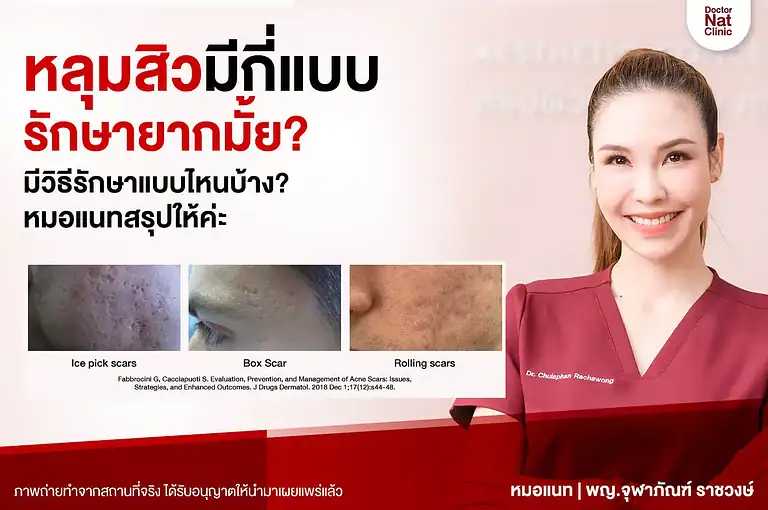 หลุมสิวมีกี่แบบ หมอแนท