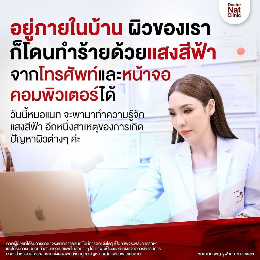 แสงสีฟ้า ฝ้า