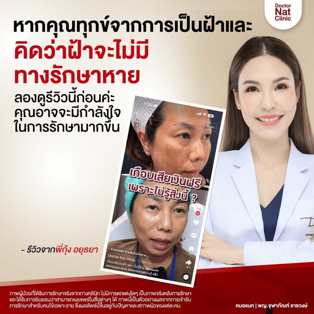 ฝ้า จาก แสงสีฟ้า