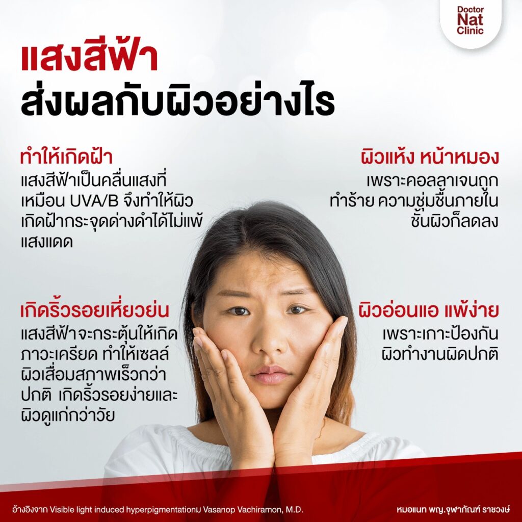 ฝ้า หมอแนท