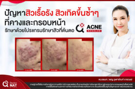 หมอแนท รักษาสิวเรื้อรัง