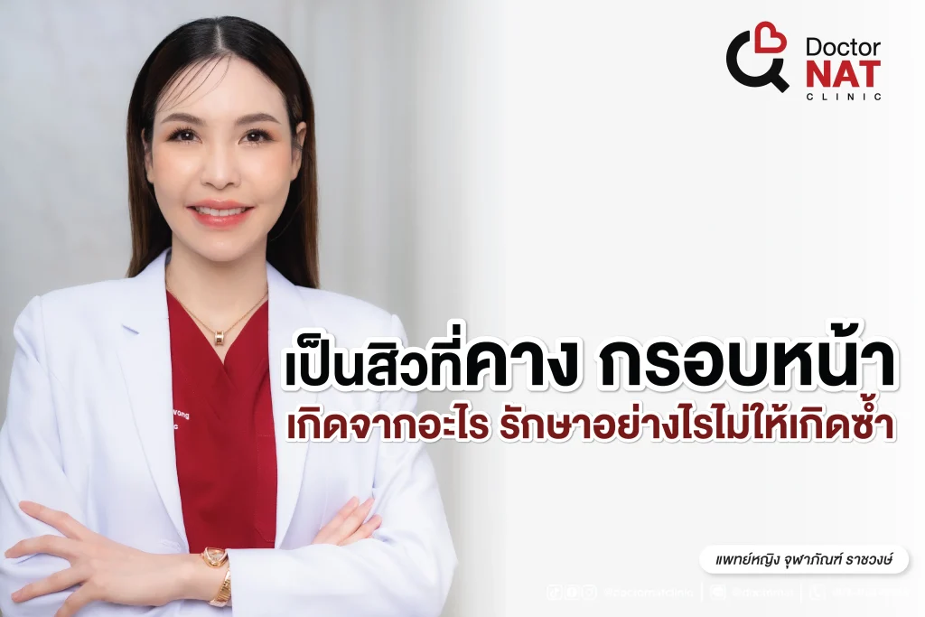 เป็นสิวที่คาง