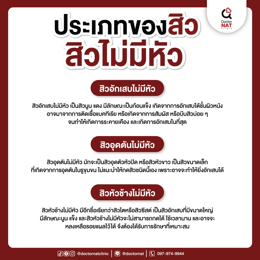 ประเภทของสิวไม่มีหัว