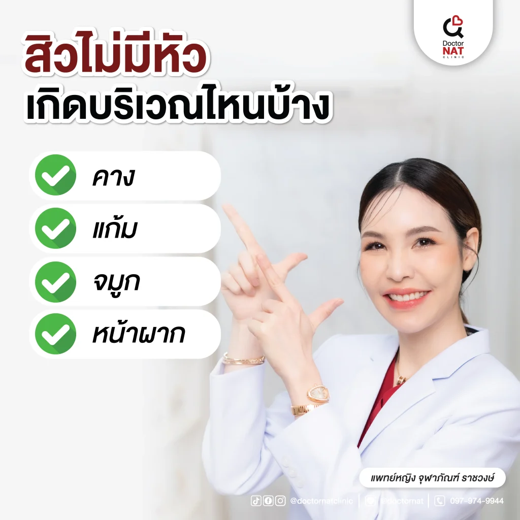 สิวไม่มีหัวเกิดบริเวณไหนบ้าง