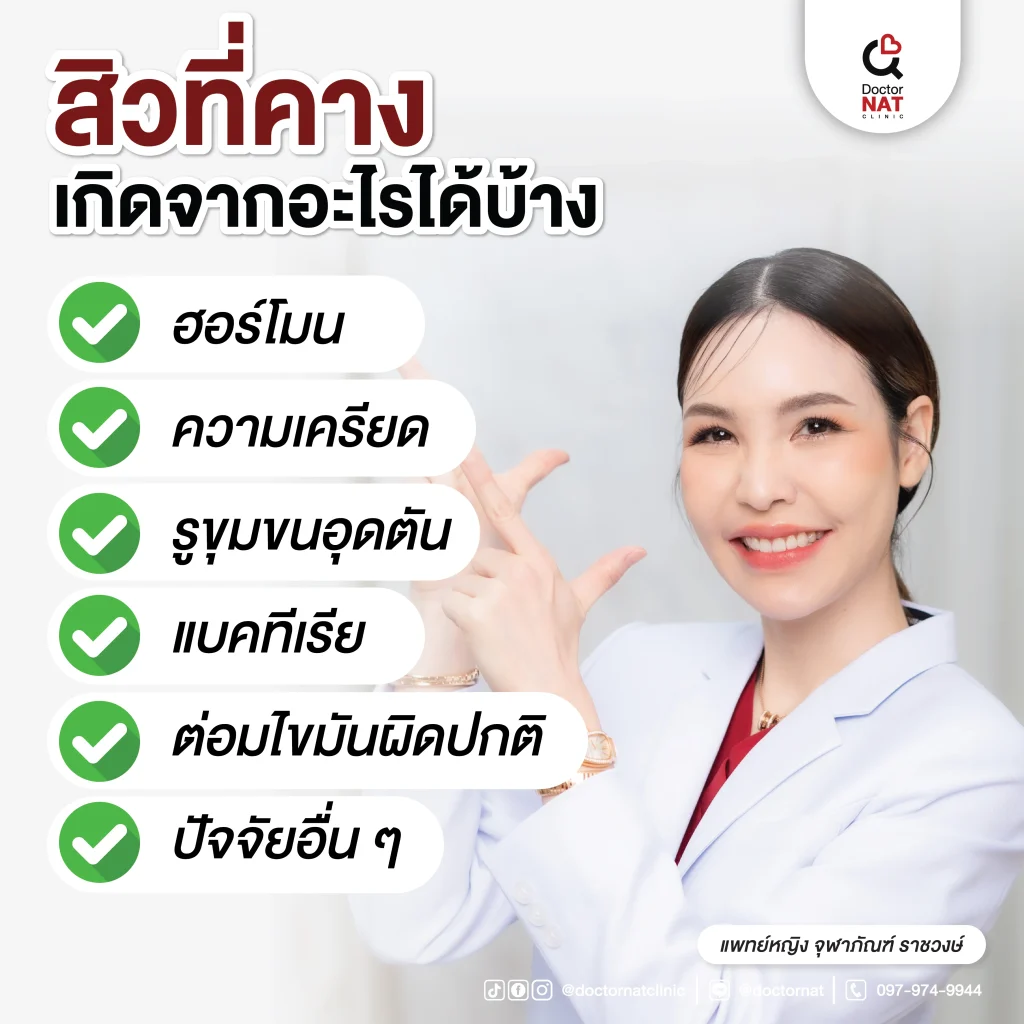 สิวที่คางเกิดจากอะไรได้บ้าง