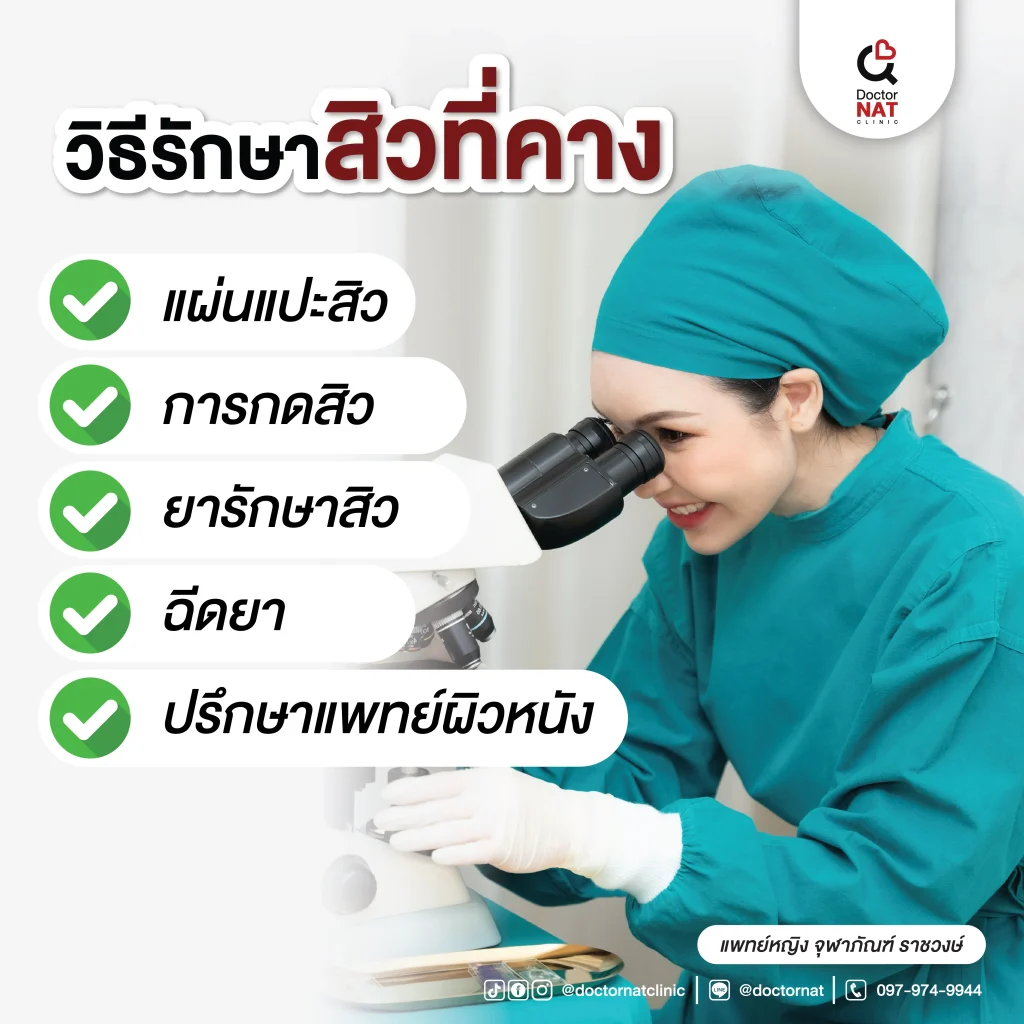 วิธีรักษาสิวที่คาง