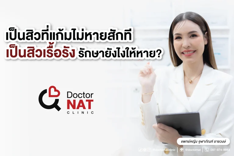 สิวเรื้อรัง