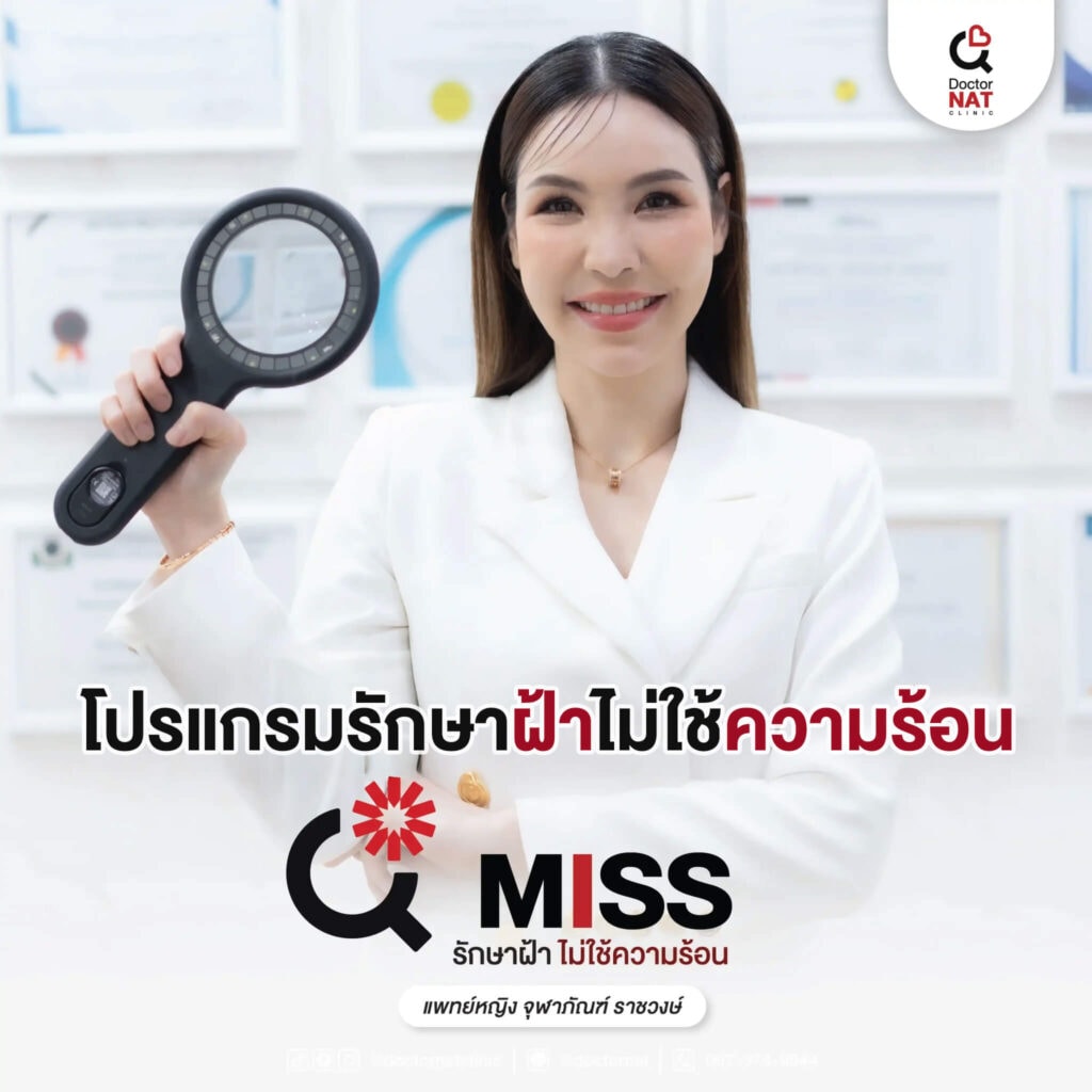 เลเซอร์ฝ้า