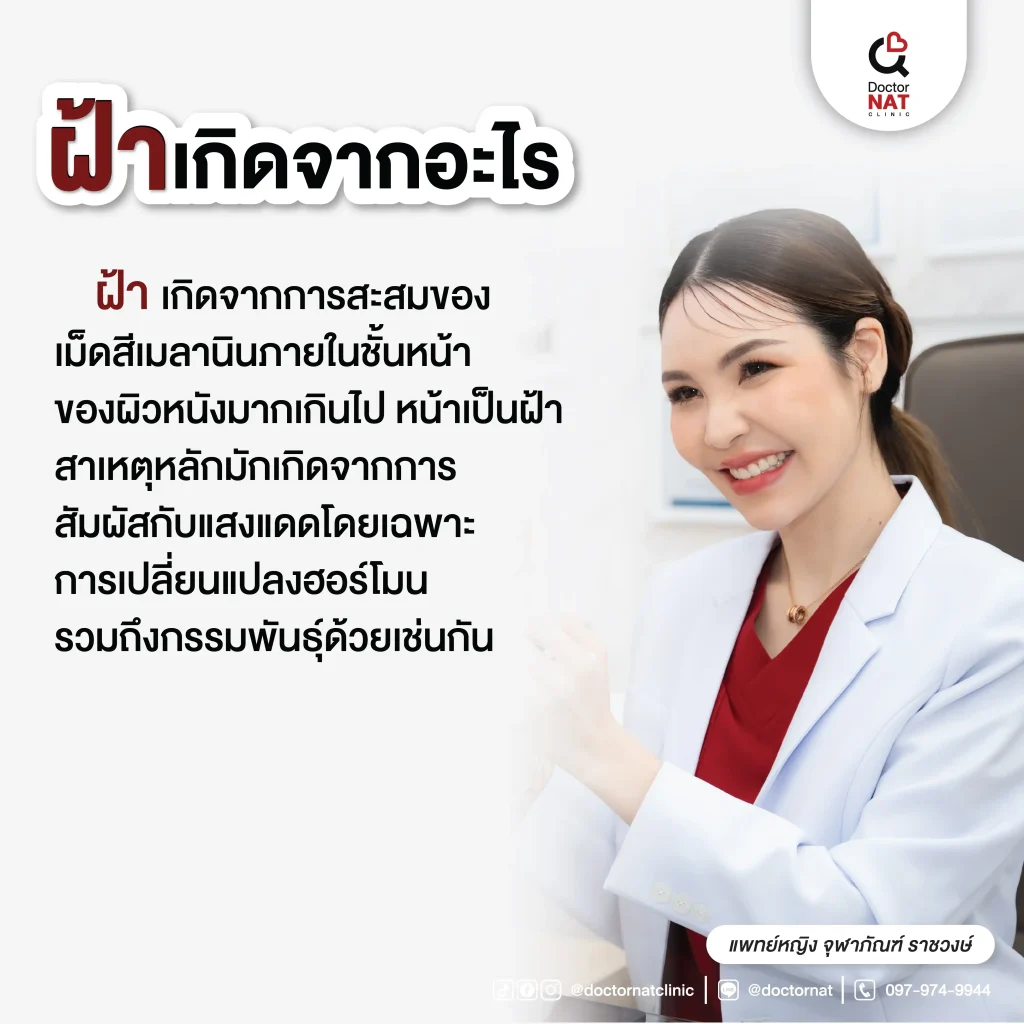 ฝ้าขึ้นหน้าเกิดจากอะไรได้บ้าง