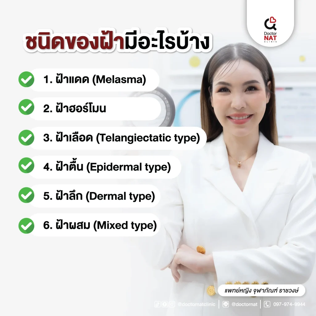 ชนิดของฝ้ามีอะไรบ้าง