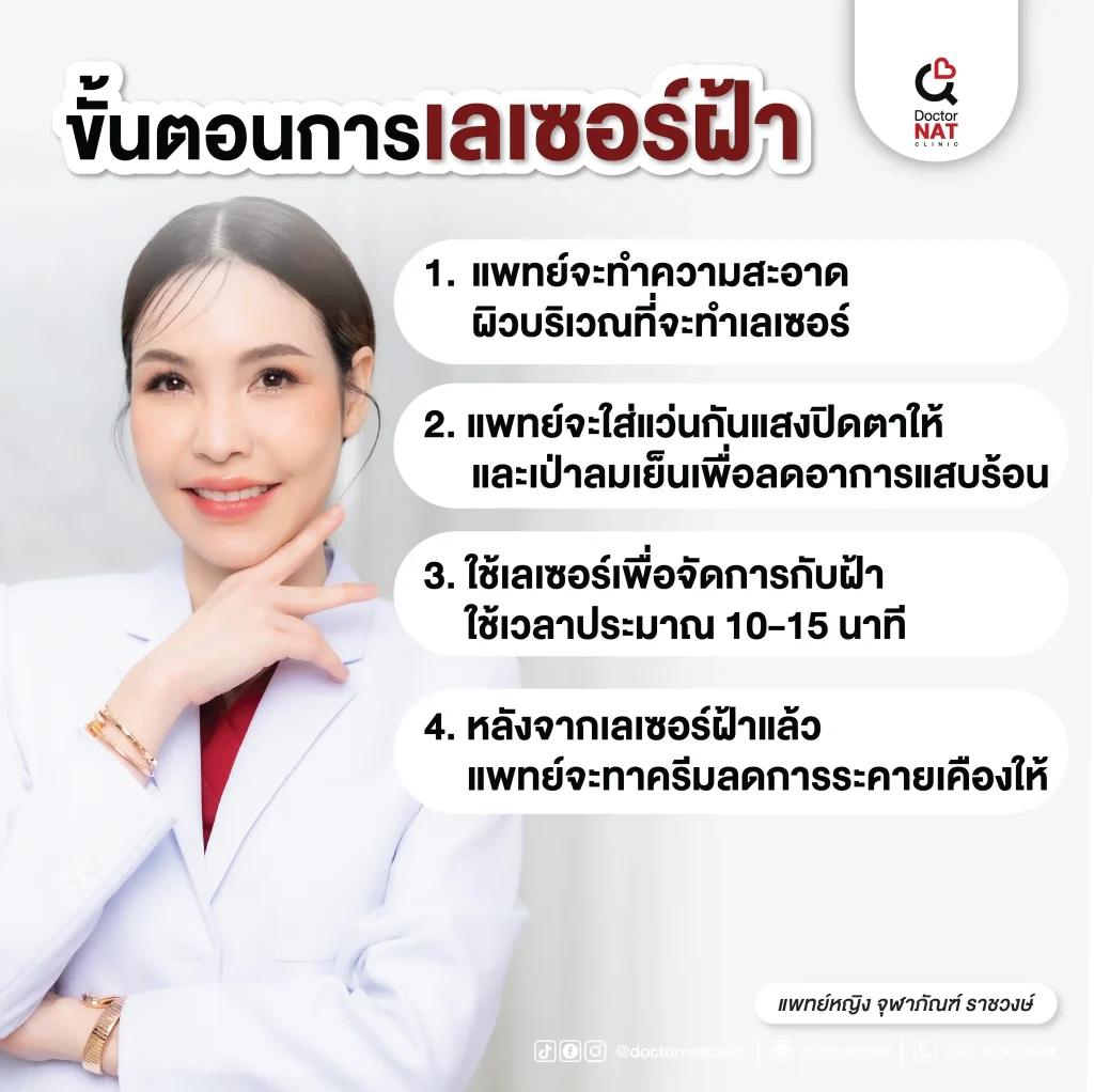 ขั้นตอนการเลเซอร์ฝ้า