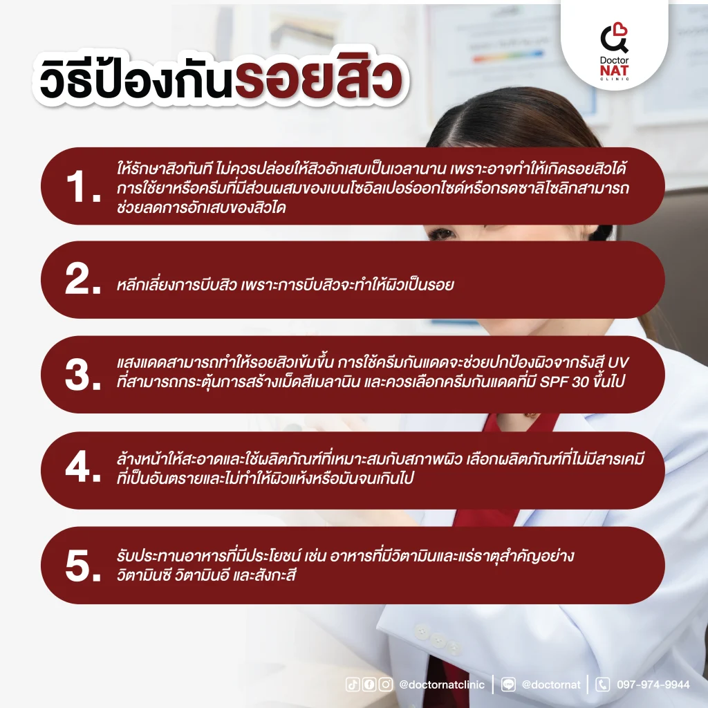 วิธีป้องกันรอยสิว