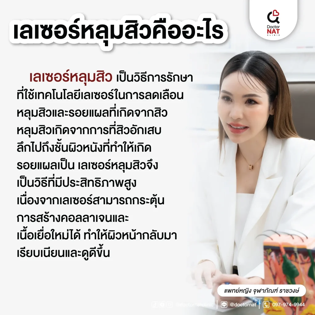 เลเซอร์หลุมสิวคืออะไร