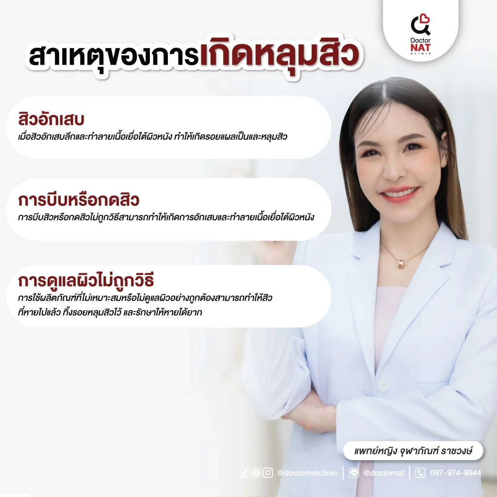 สาเหตุของการเกิดหลุมสิว