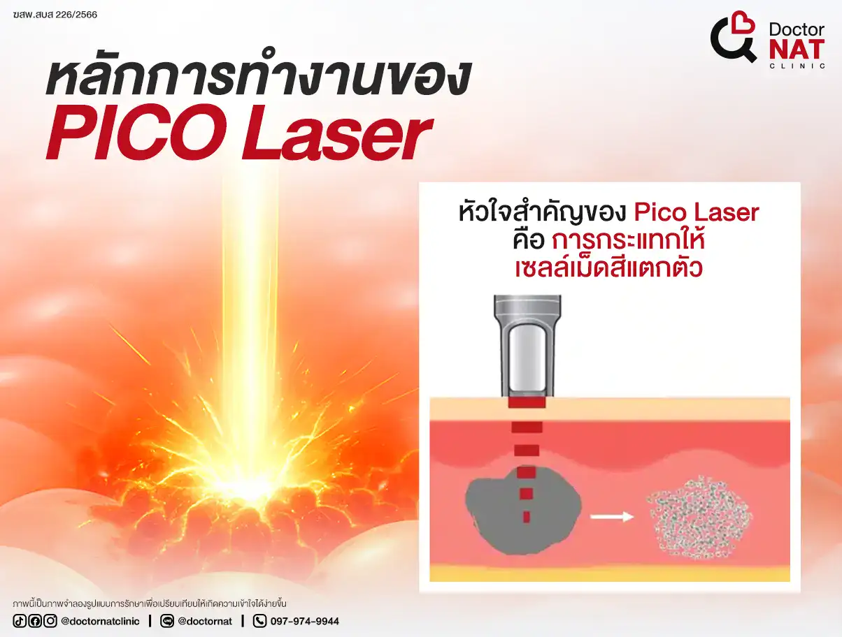 หลักการทำงานของ Pico Laser