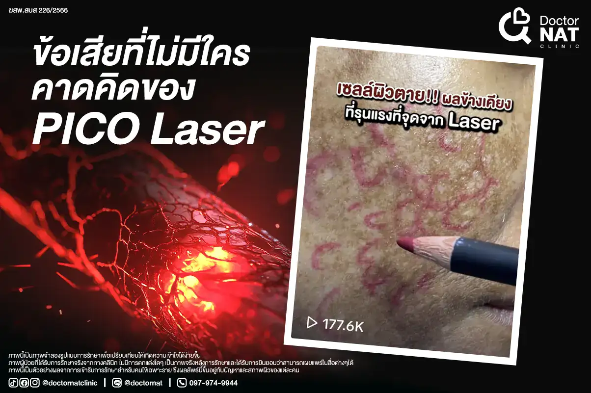 ข้อเสีย ที่ไม่มีใครคาดคิดของ Pico Laser