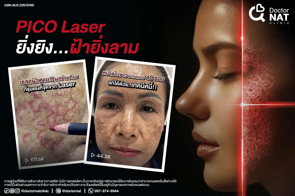 หมอแนท แชร์เคสจริง
Pico Laser ยิ่งยิง…ฝ้ายิ่งลาม