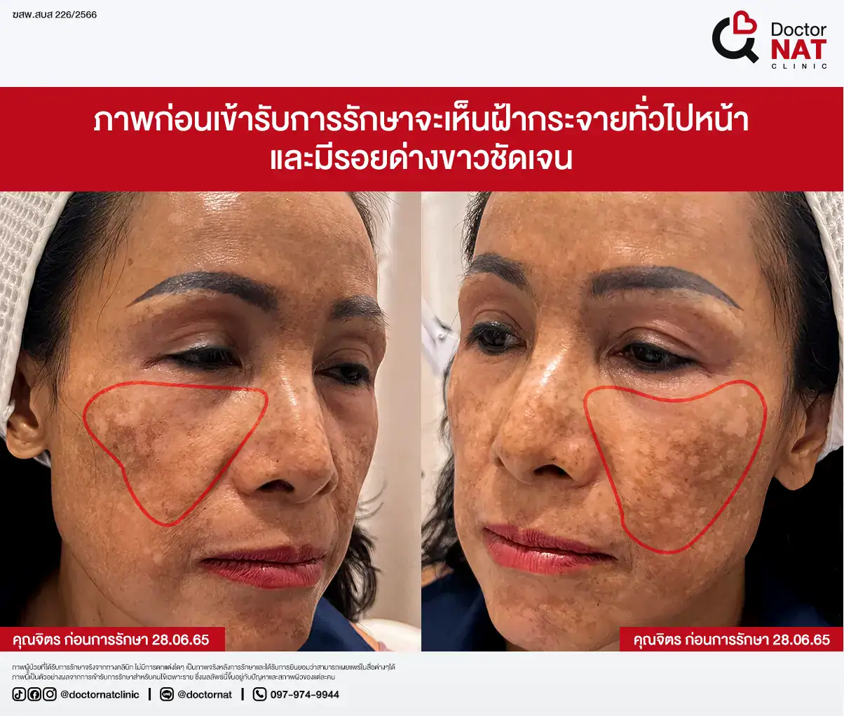 จุดเปลี่ยนของความหวัง...เริ่มต้นจากคนใกล้ตัว