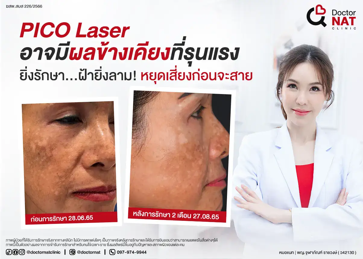 PICO Laser อาจมีผลข้างเคียงที่รุนแรง