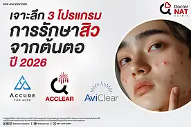 เจาะลึก 3 โปรแกรม การรักษาสิวจากต้นตอ ปี 2026
