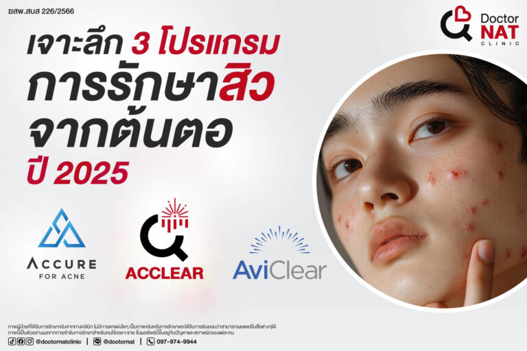 เจาะลึก 3 โปรแกรม การรักษาสิวจากต้นตอ ปี 2025