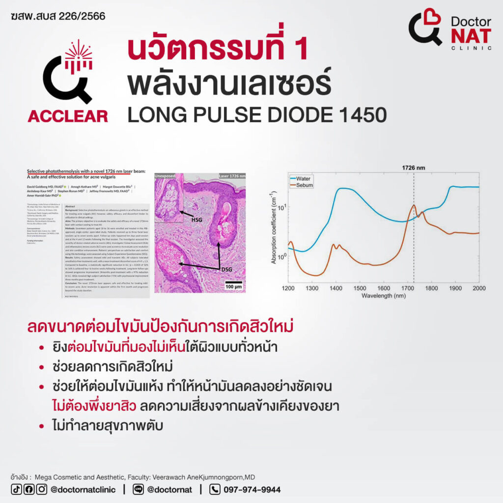 ACCLEAR โปรแกรมรักษาสิว ผสาน 2 เทคโนโลยี