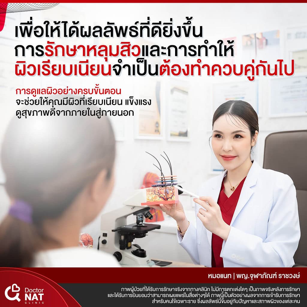 โปรแกรมเบลอขอบหลุมสิว ไม่ใช้เลเซอร์ PCI Resurface Doctor NAT Clinic