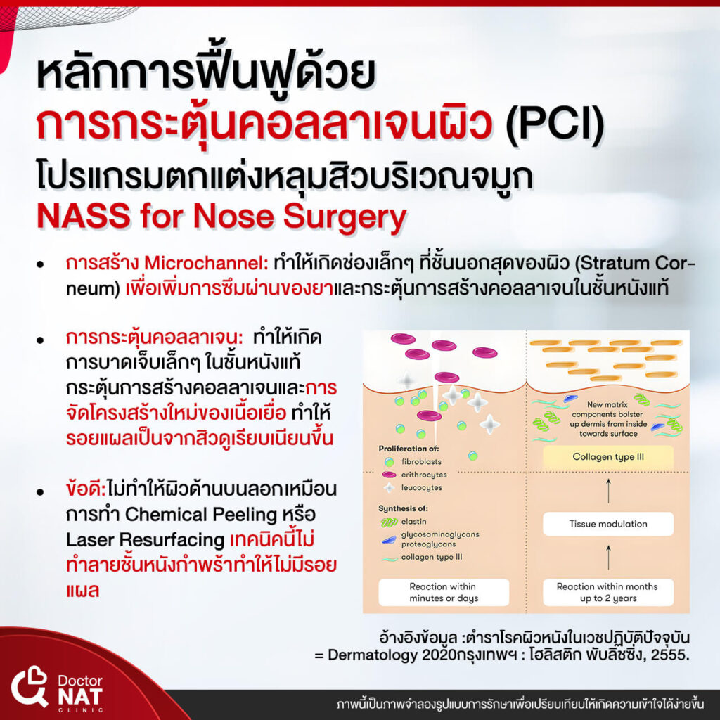 NASS for Nose Surgery Doctor NAT Clinic
