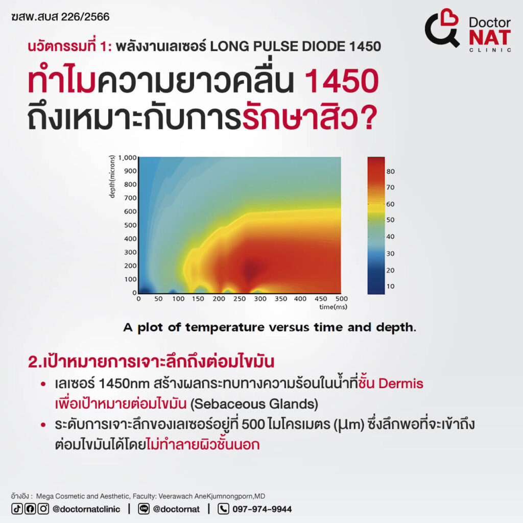 ACCLEAR โปรแกรมรักษาสิว ผสาน 2 เทคโนโลยี