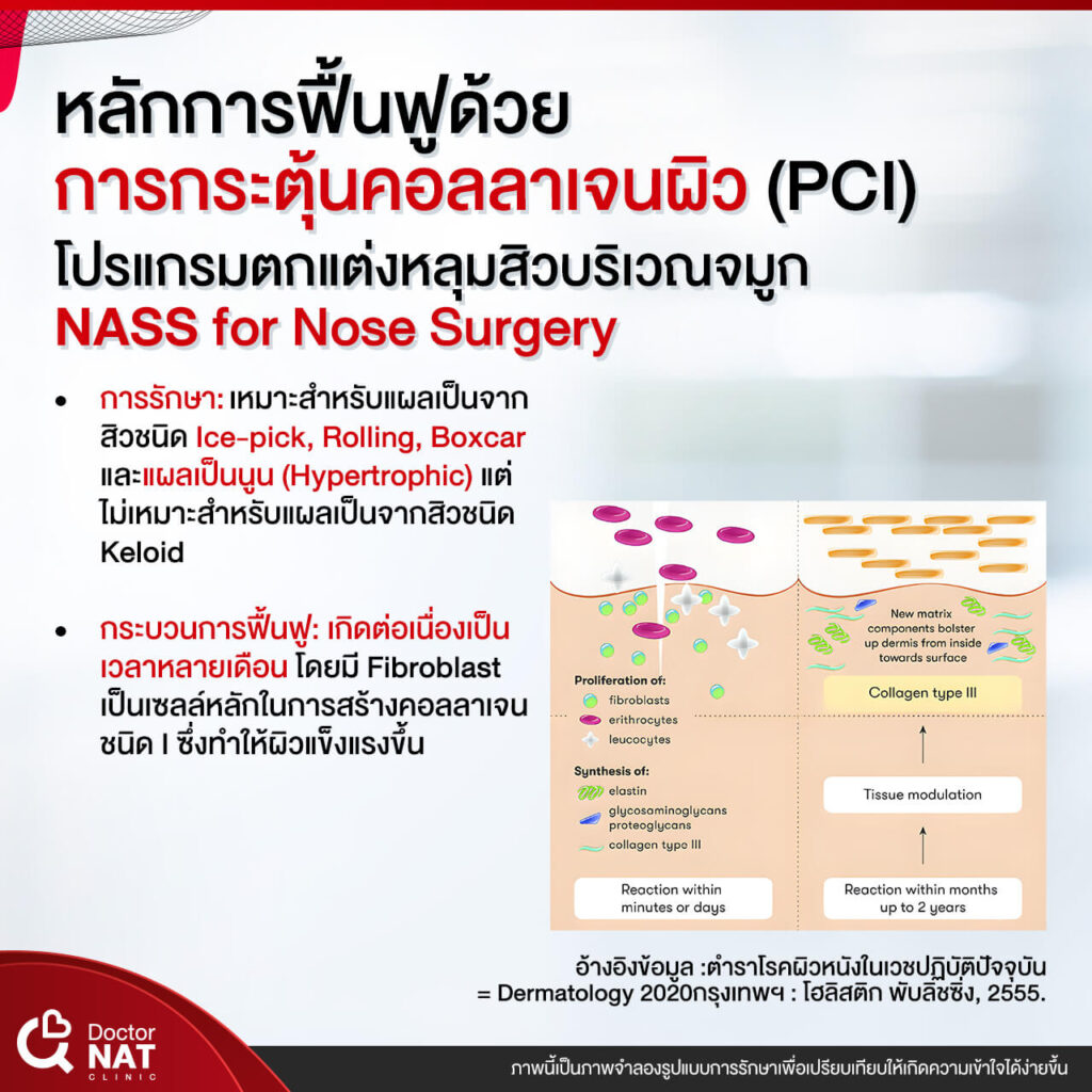 NASS for Nose Surgery Doctor NAT Clinic