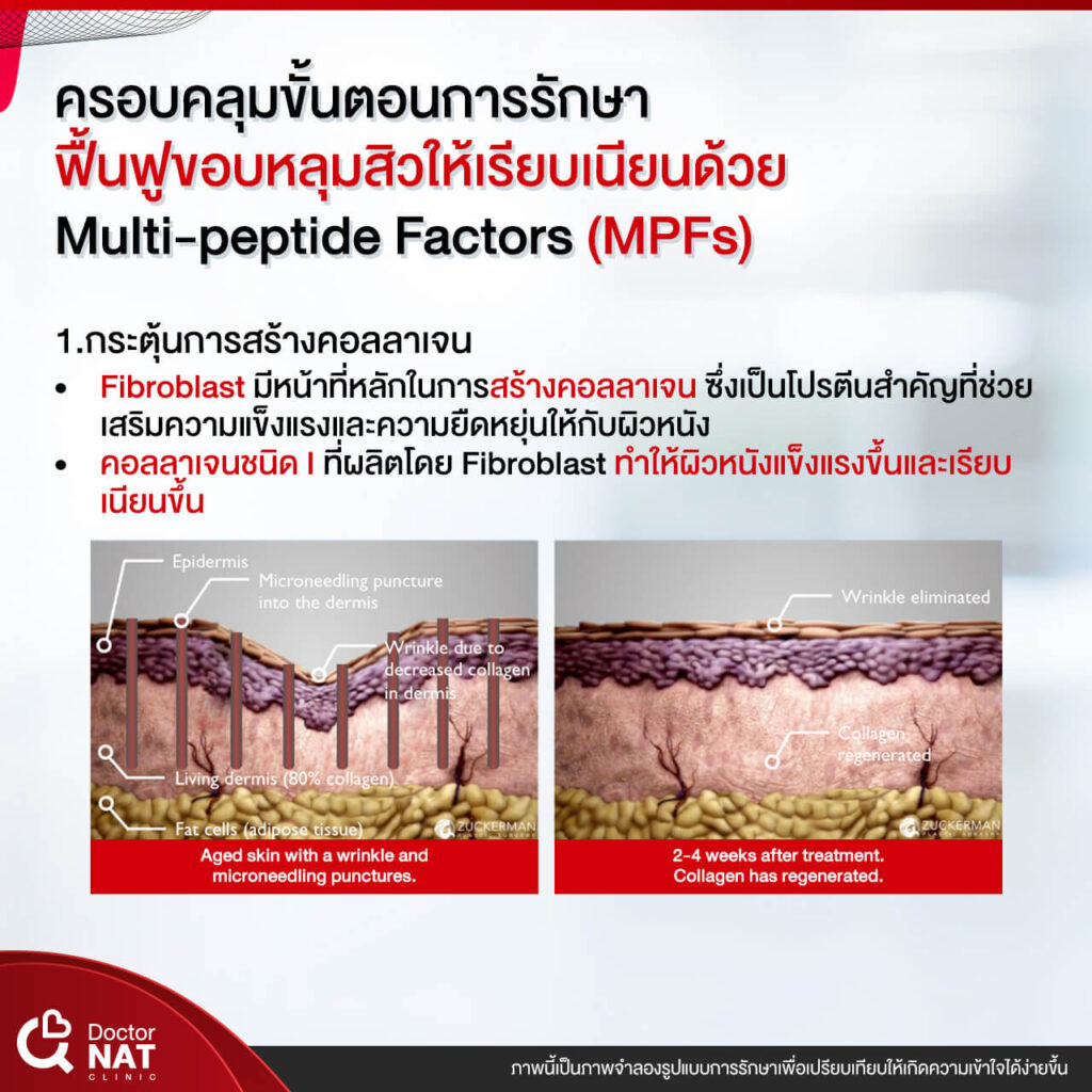 NASS for Nose Surgery Doctor NAT Clinic