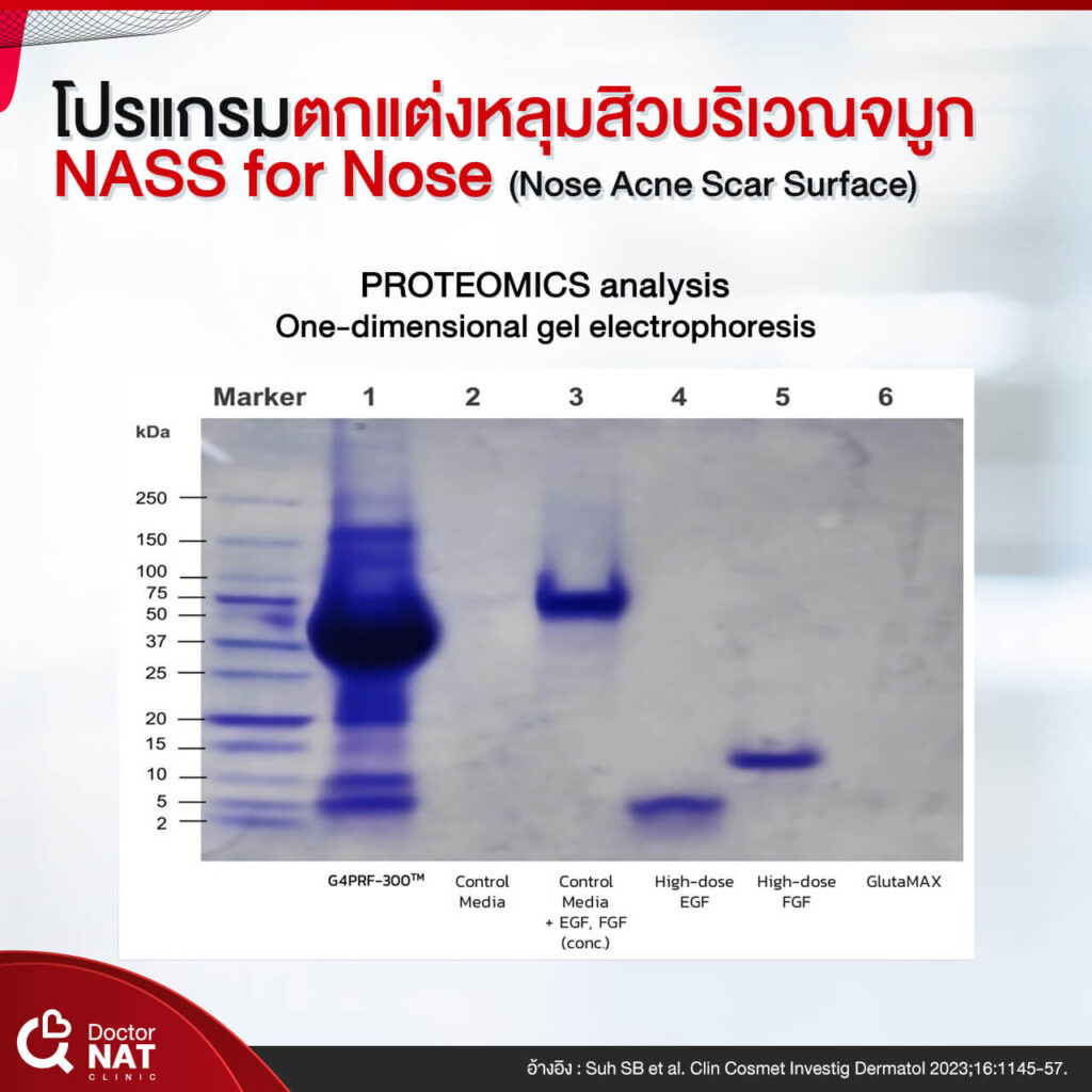 NASS for Nose Surgery Doctor NAT Clinic