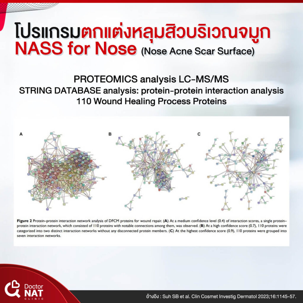 NASS for Nose Surgery Doctor NAT Clinic