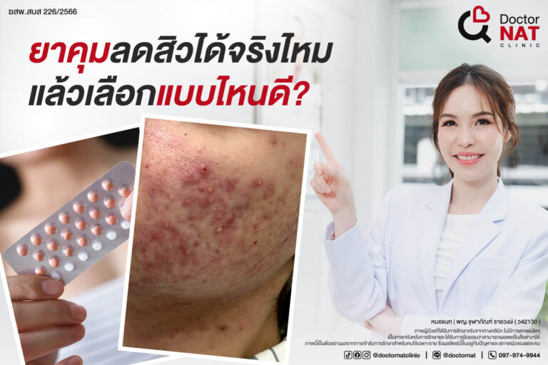 ยาคุมลดสิวได้ผลจริงหรือไม่? Doctor NAT Clinic
