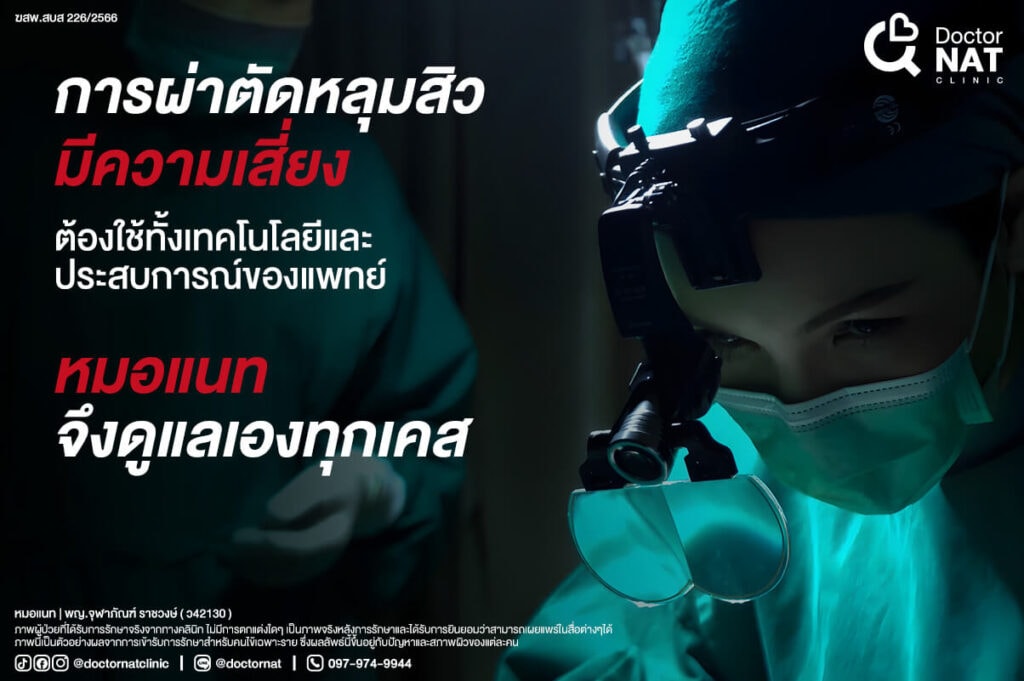 การผ่าตัดพังผืดหลุมสิว มีความเสี่ยง