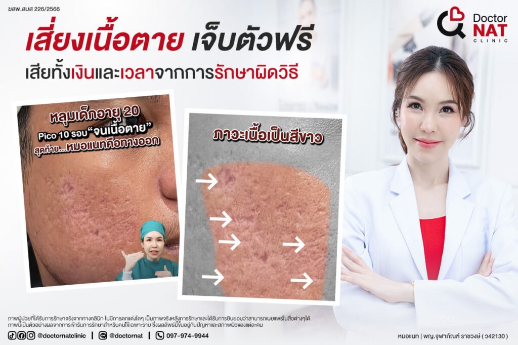 ผ่าตัดหลุมสิว เสี่ยงเนื้อตาย