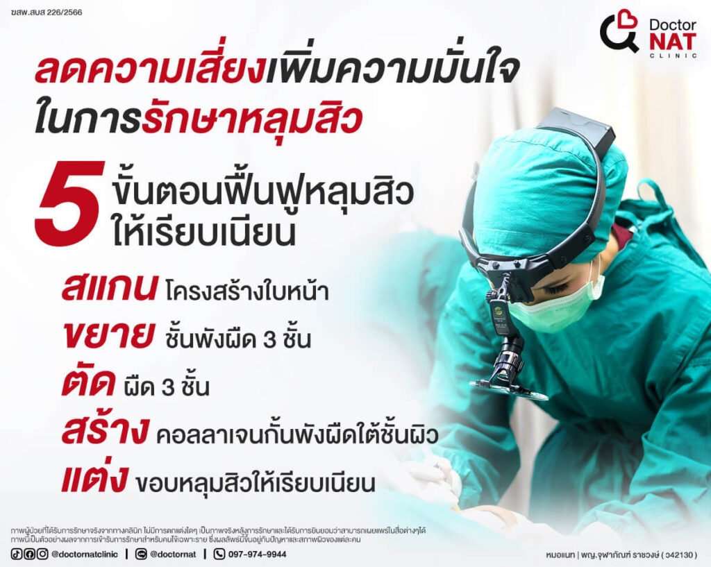 ลดความเสี่ยงในการผ่าตัดหลุมสิว