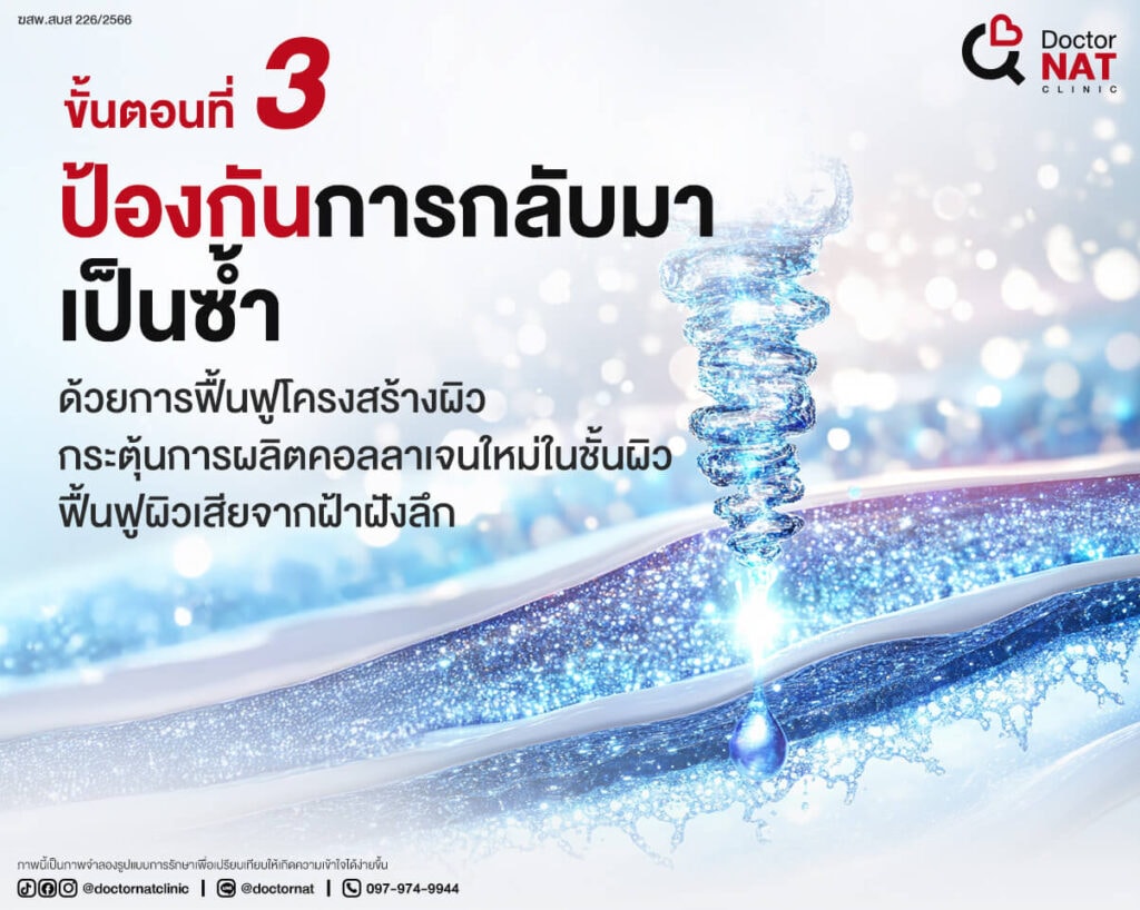 ขั้นตอนที่ 3 
ป้องกันการกลับมาเป็นซ้ำ
