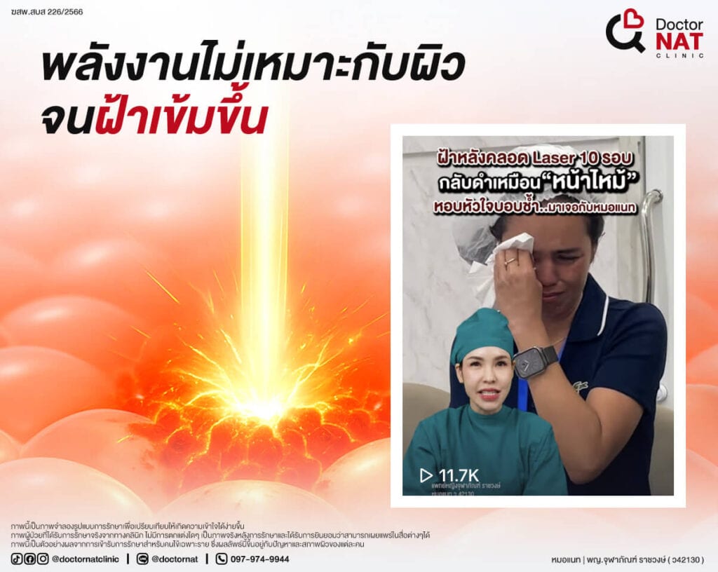 พลังงานไม่เหมาะกับผิวจนสร้างเม็ดสีเกินปกติ