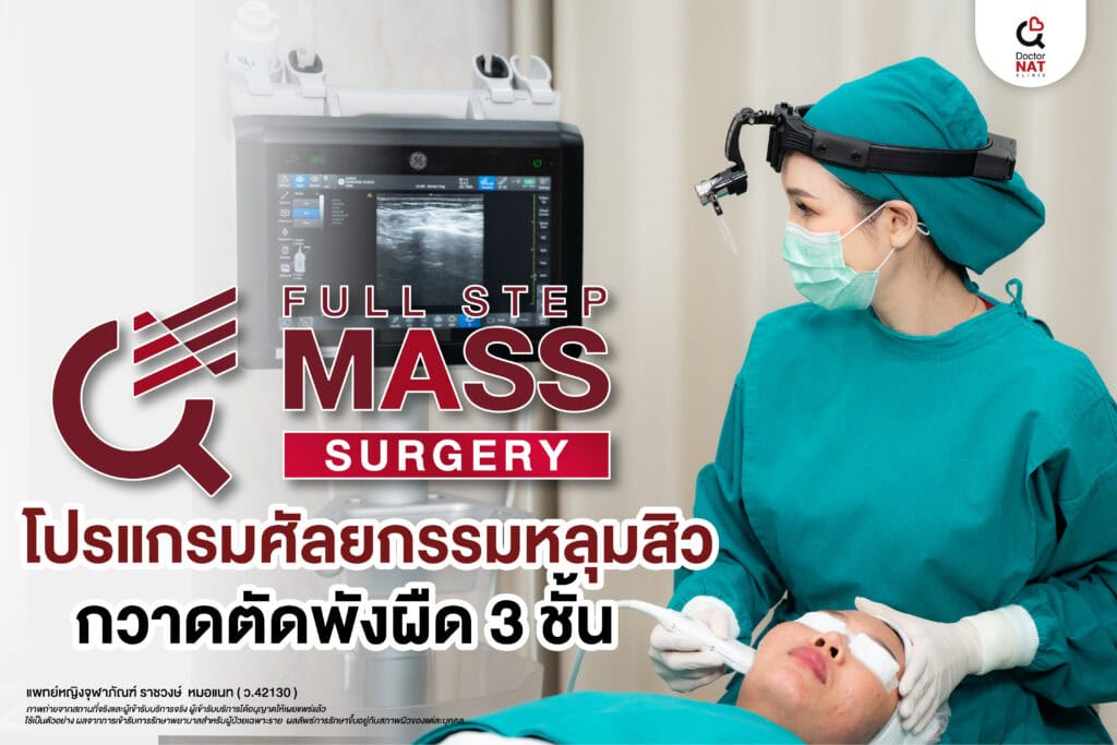 Doctor NAT Clinic ให้บริการรักษาหลุมสิว ด้วยโปรแกรม MASS Surgery
